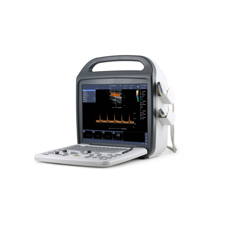 Umus002 Vet Ultrasound System--Portable, 320mm Depth, Dicom 3.0, 500GB Storage
