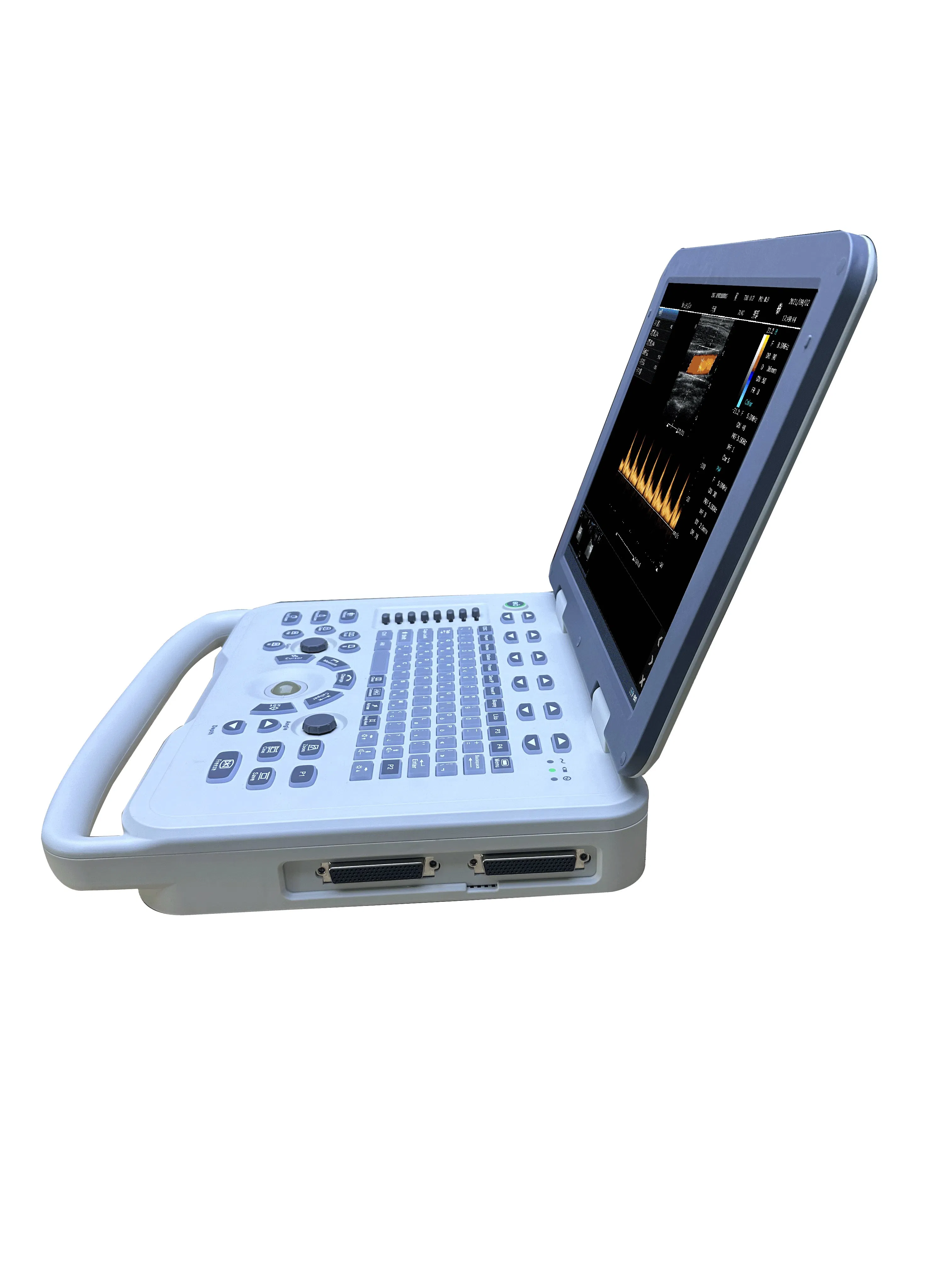 Advanced Veterinary Color Ultrasound System for Animal Health Monitoring