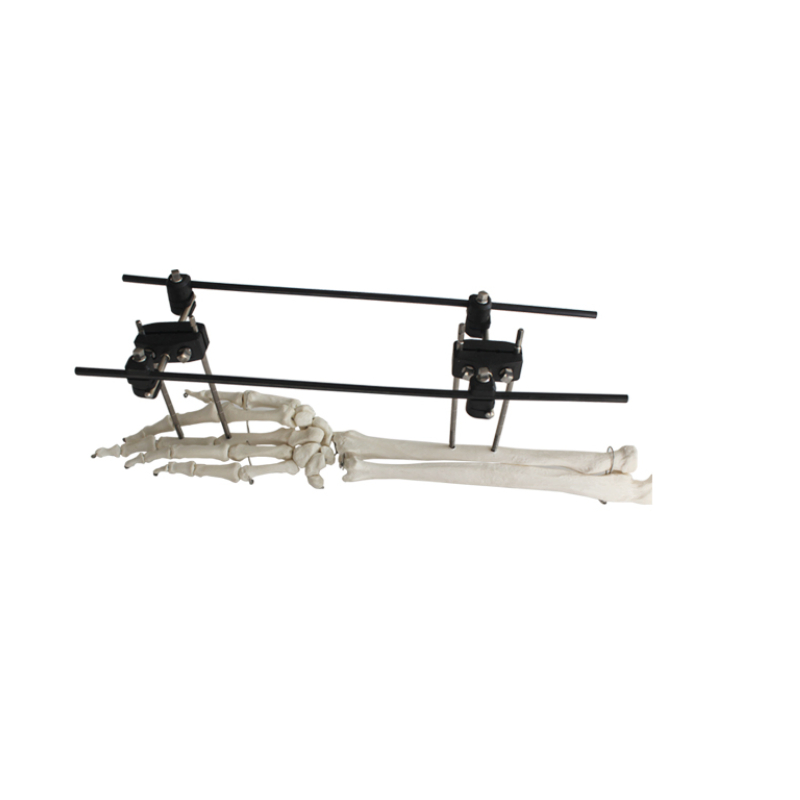 Orthopedic Surgical External Fixation Support Peek Tibial Proximal Nail Target Device