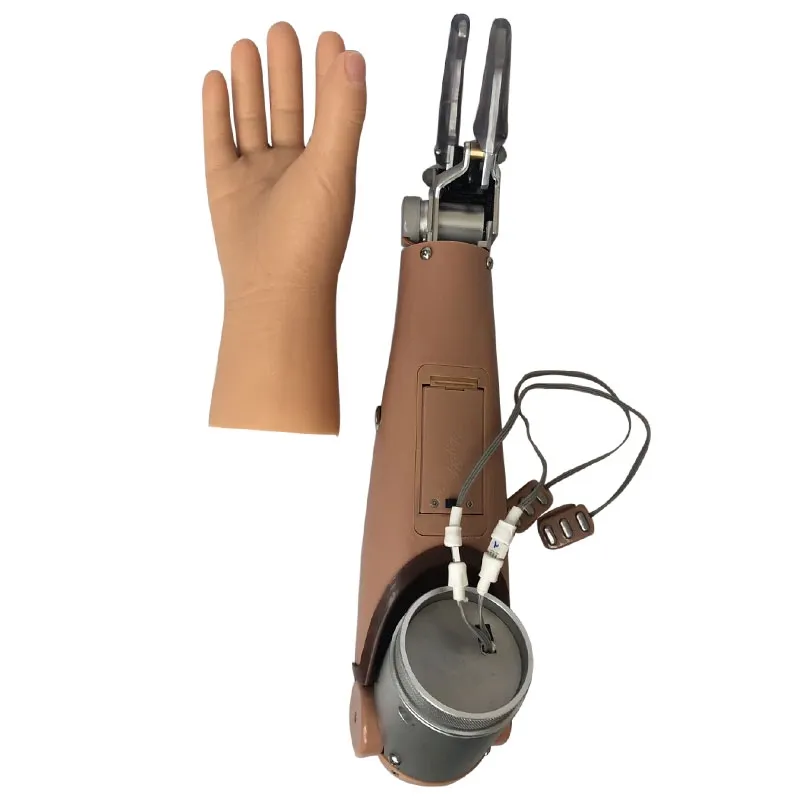 Myoelectric Prosthesis Physical Therapy Equipment Hand 1