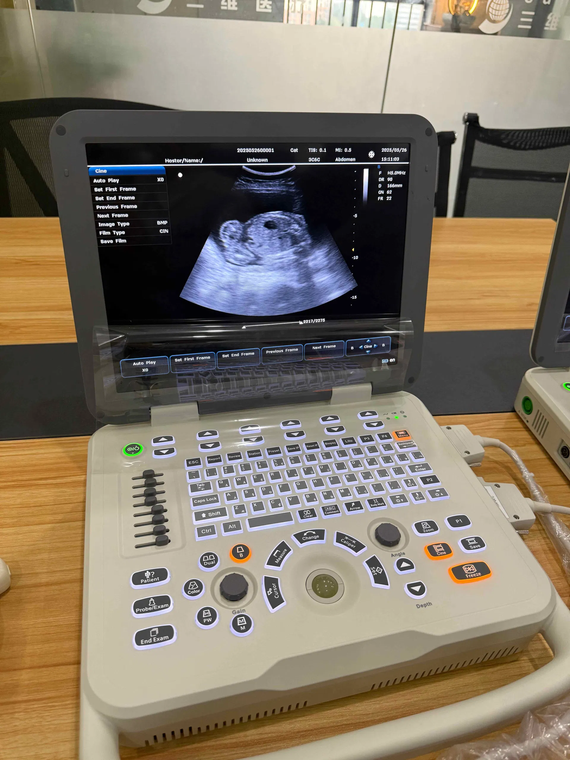 Portable Ultrasound Unit