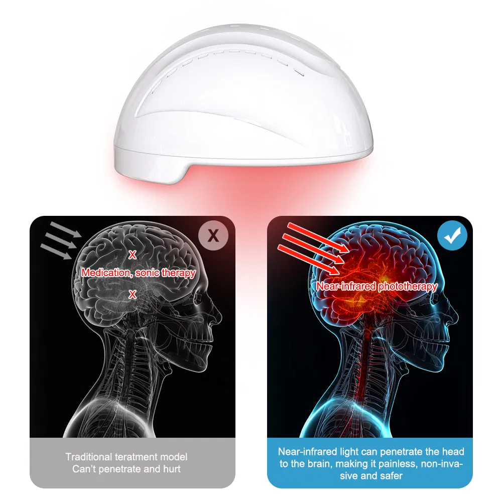 Suyzeko Mental Health 810nm LED Light Therapy Brain Photobiomodulation Helmet