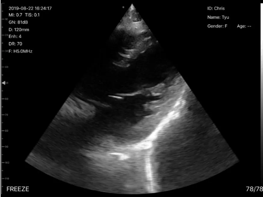 Ultrasound Scanner 5