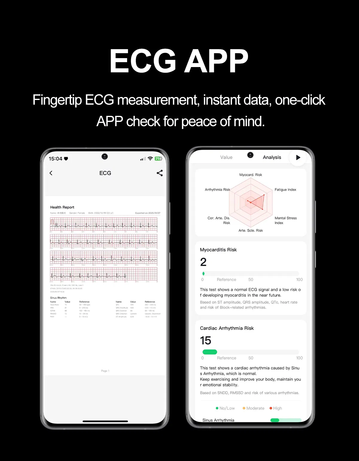 High Quality Waterproof Smart Watch Ai Voice Assistant Sos Emergency Call S101 Health Smartwatch for Men Women