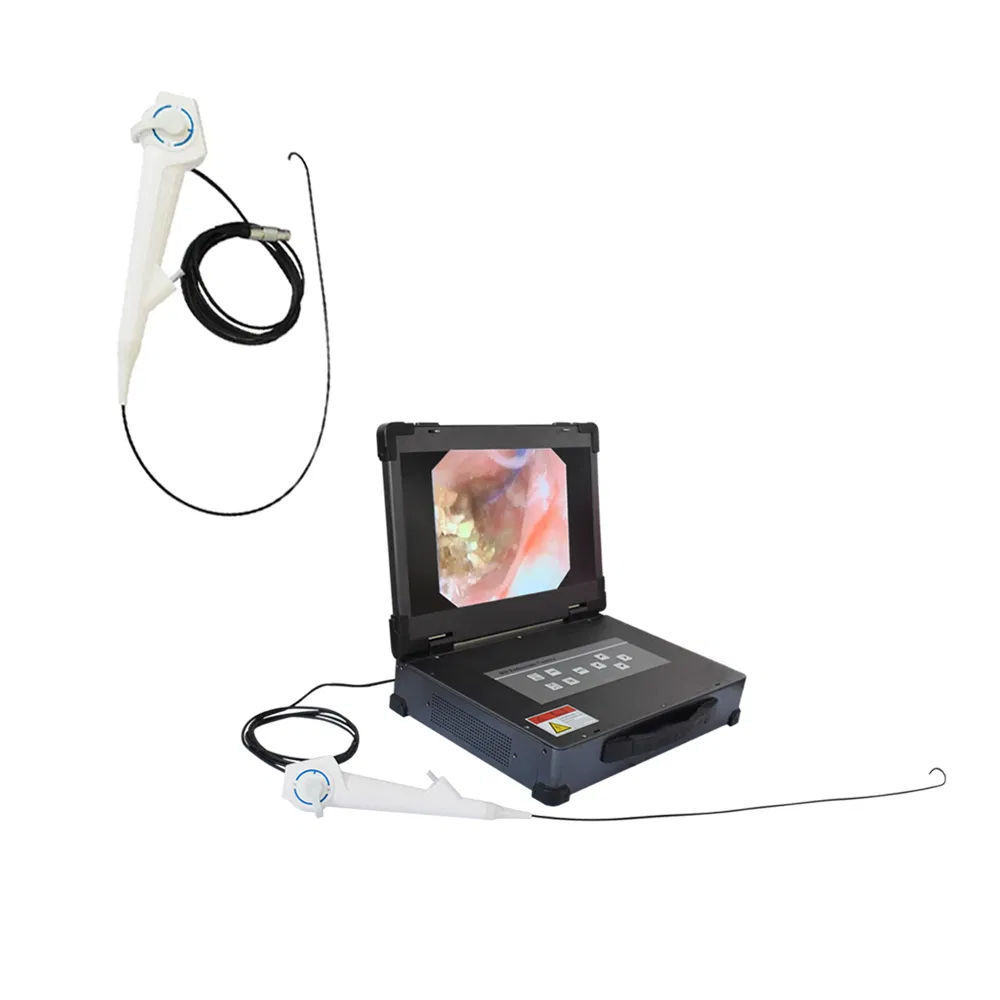 Telehealth Endoscopy System Ureteroscope Flexible Ureteroscope