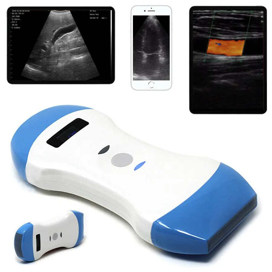 Ultrasound Scanner 1