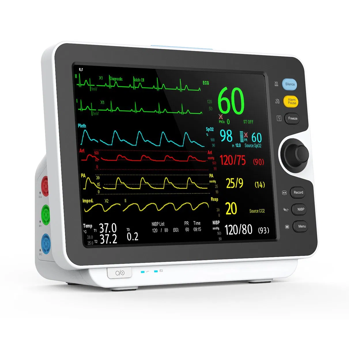 Monitor Multiparamétrico de Sinais Vitais para Pacientes Adultos, Pediátricos e Neonatais em Sala de Emergência, Centro Cirúrgico e UTI Hospitalar