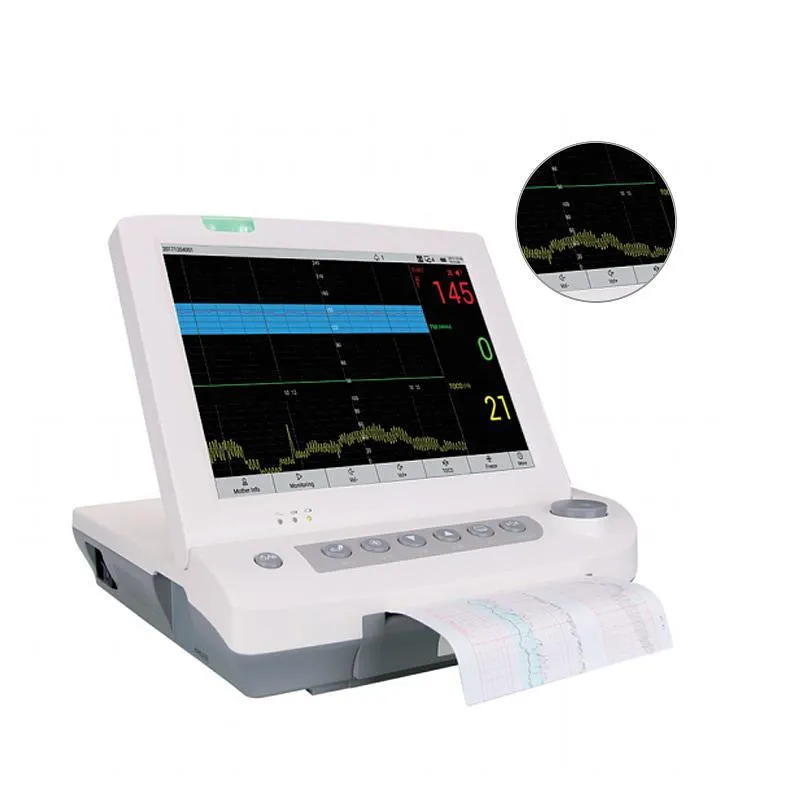 Detalhe Monitor Fetal 1