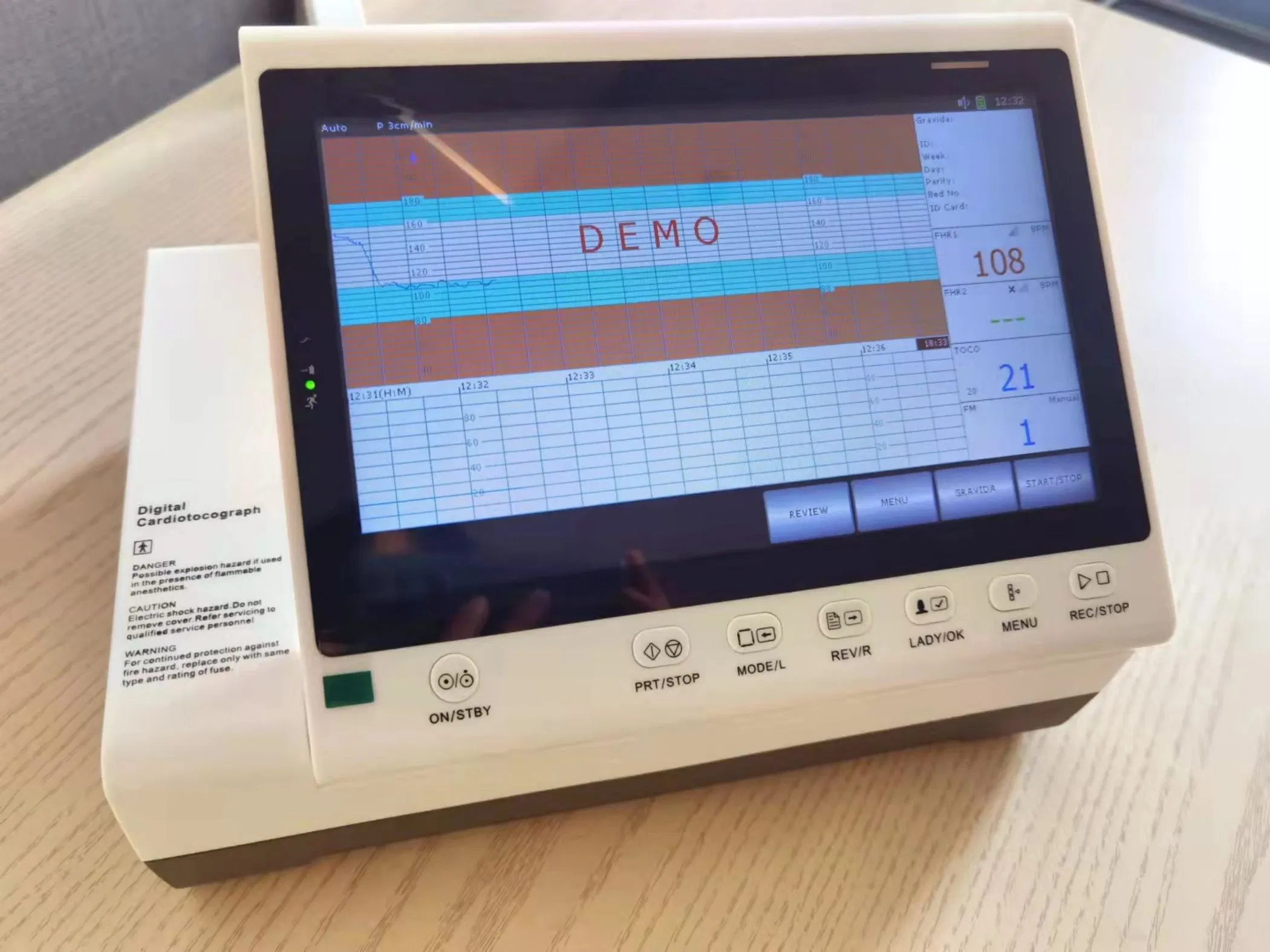 Monitor Fetal Materno Portátil 10.2 1inch LCD