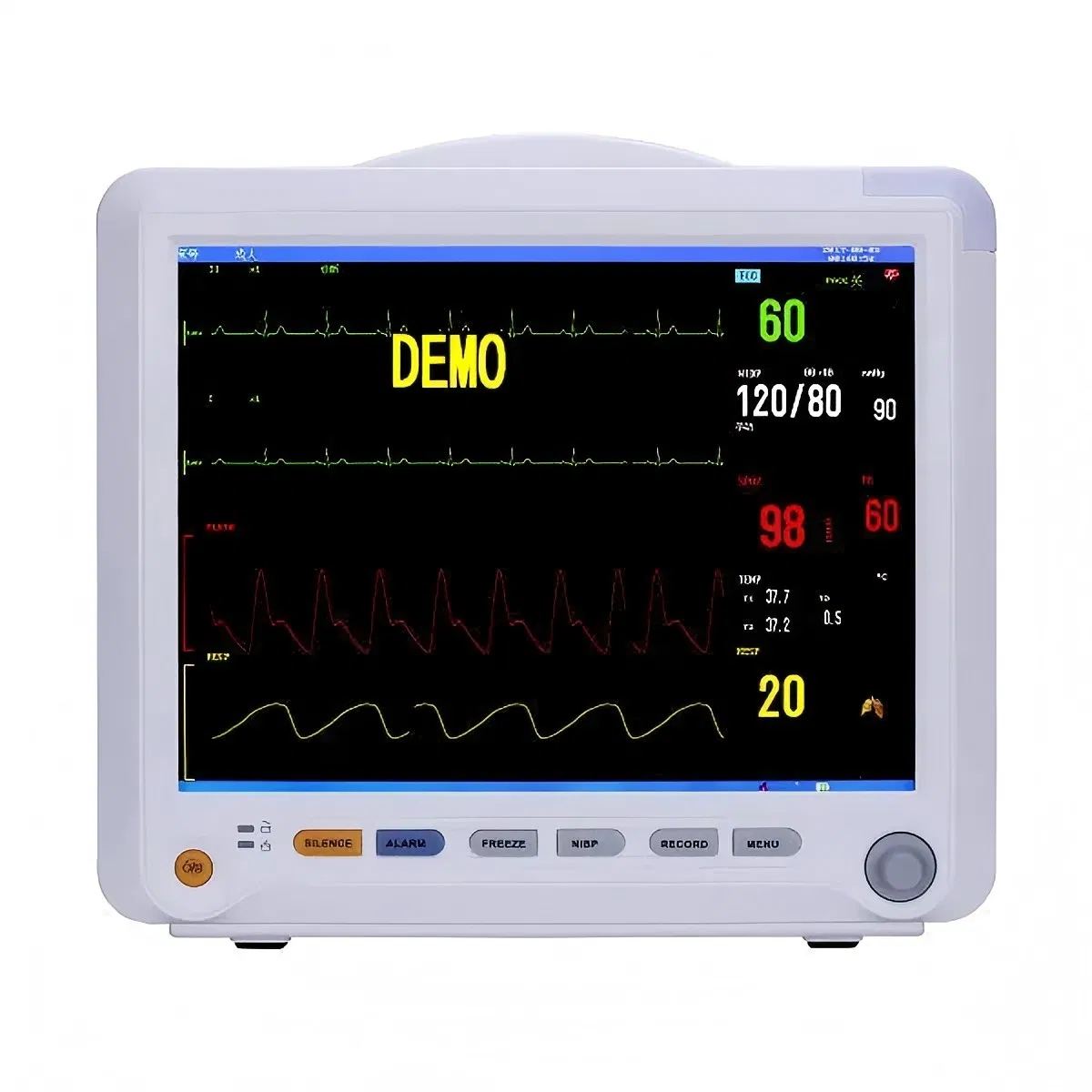 Monitor de Paciente Eficiente em Custo 12.1 Polegada Aplicável a Adulto, Pediátrico e Neonatal