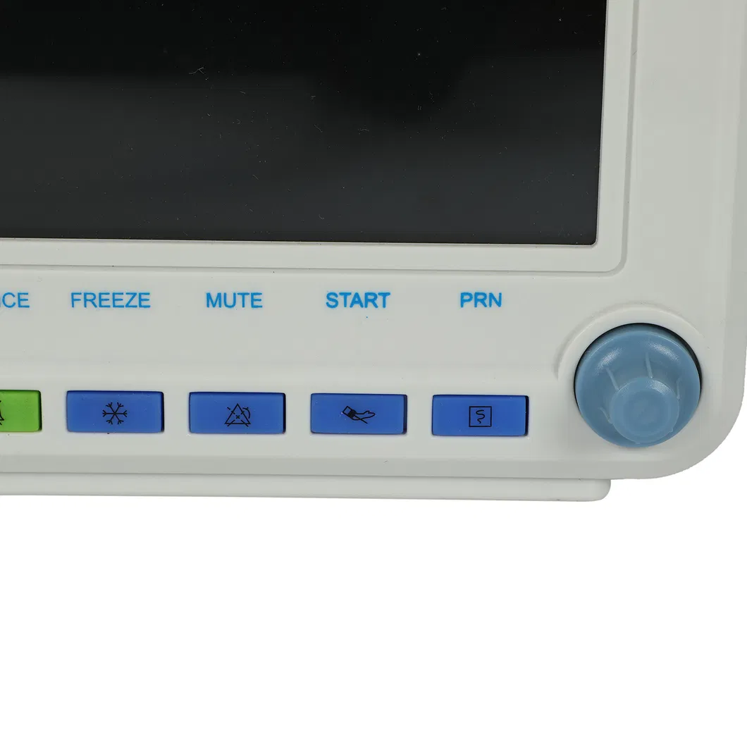 Monitor Detalhe 1
