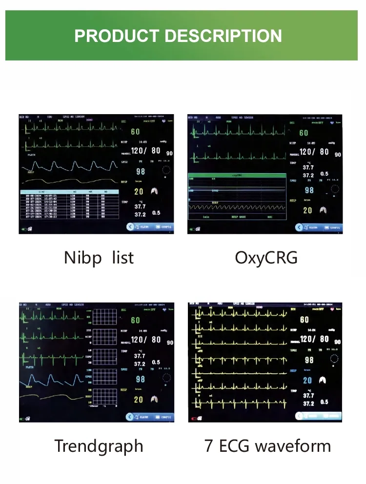 Interface do Monitor
