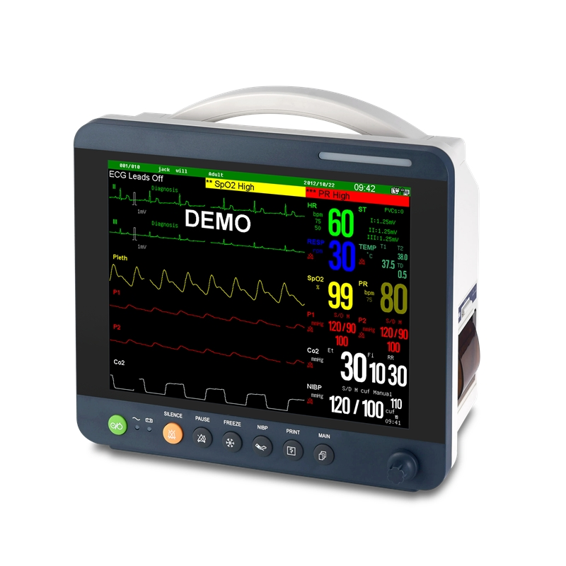 12inch Monitor de Paciente Multi Parâmetro com Tela Sensível ao Toque para Hospital Monitor de Paciente Portátil