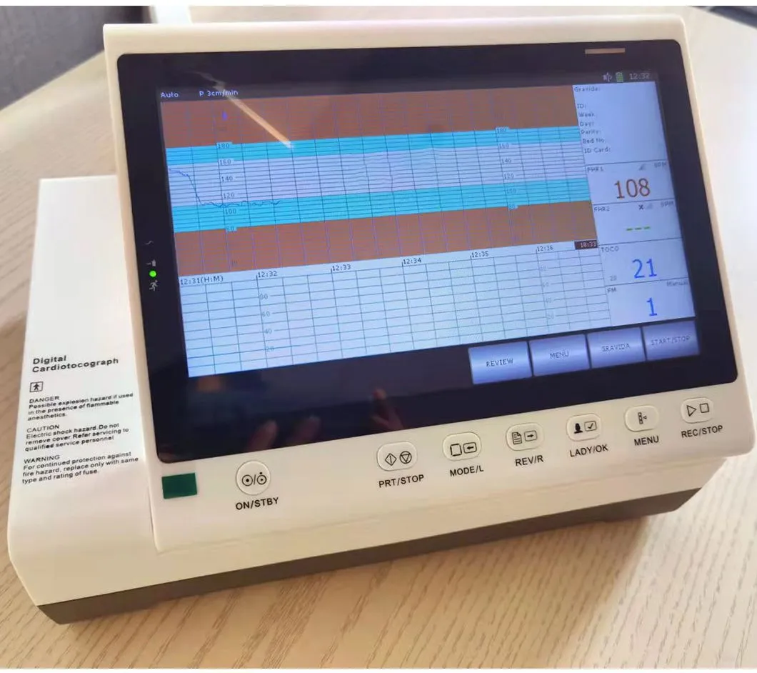 Detalhe Monitor Fetal 1