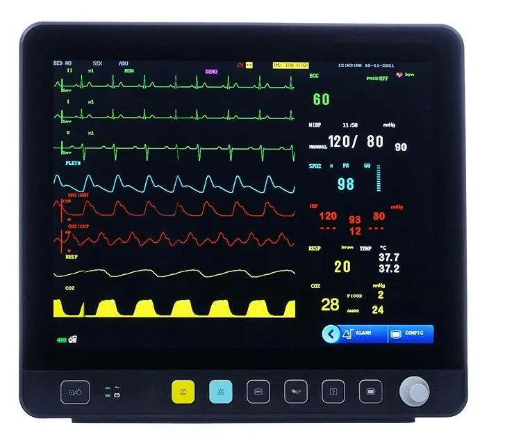 Monitor 15