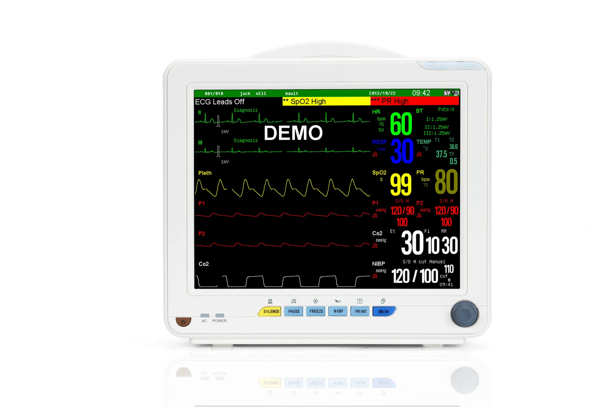 Monitor de Paciente com Tela Sensível ao Toque 12 Polegadas 6 Parâmetros Eficiente em Custo