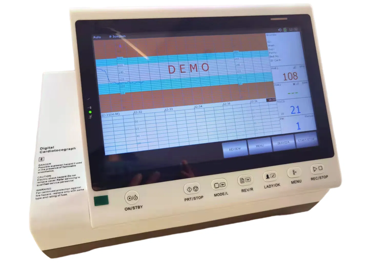 Monitor Fetal Avançado com Sonda para Gêmeos e Interpretação Automática