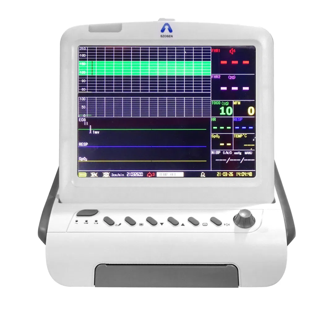 Monitor Fetal 1