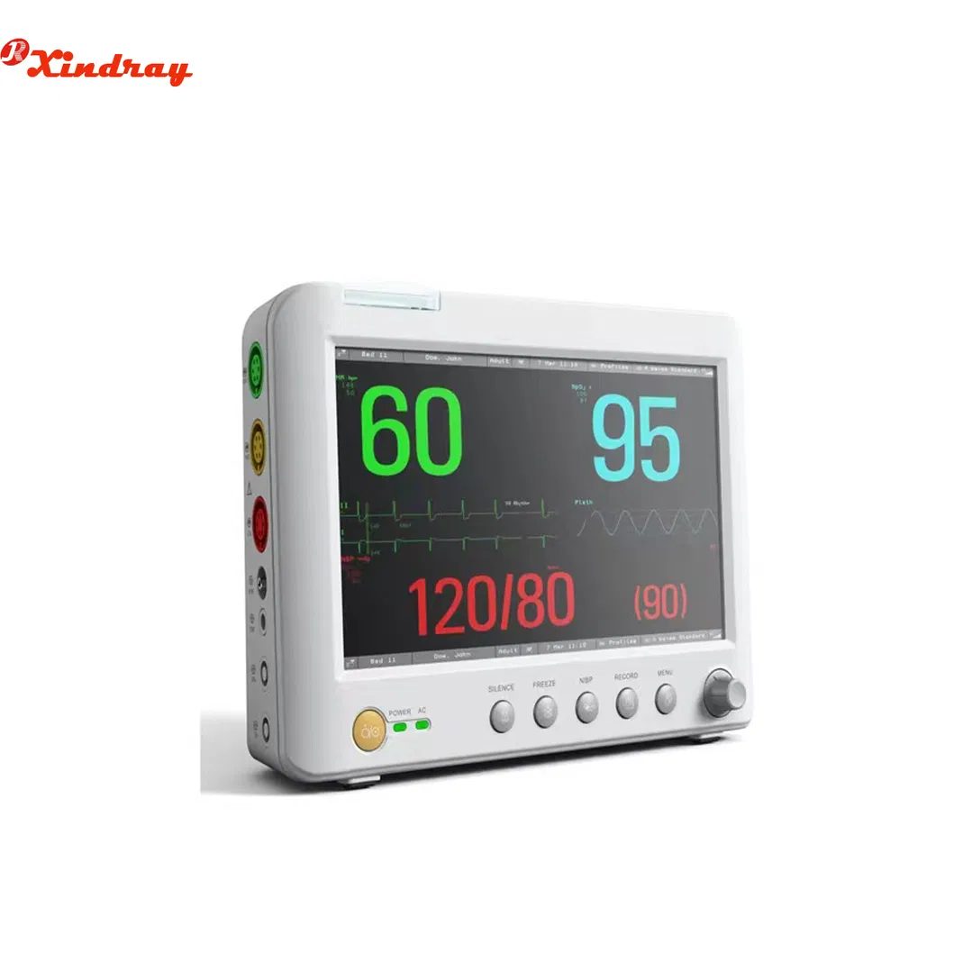 Equipamento Médico de Tela Sensível ao Toque para Quarto de UTI Monitor Portátil de Paciente com Múltiplos Parâmetros