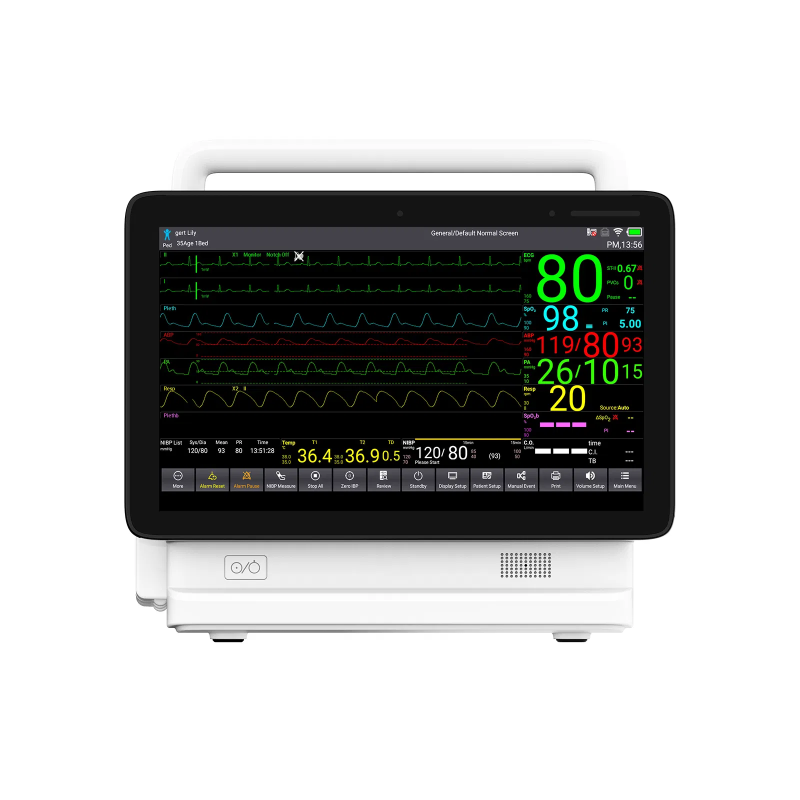 Ts15 Monitor de Paciente UTI Etco2 Monitor de Sinais Vitais ECG