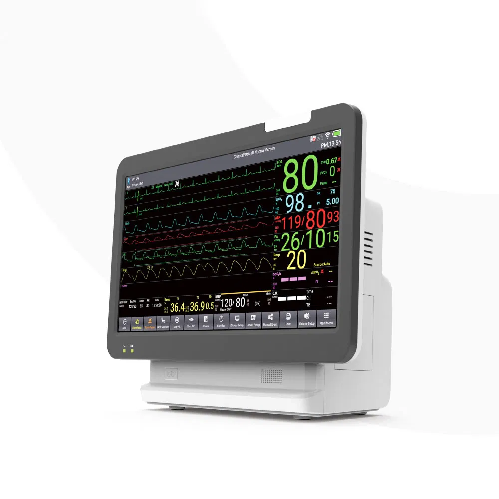 Sistema de Monitoramento Remoto de Pacientes em UTI Avançado Contec Ts18