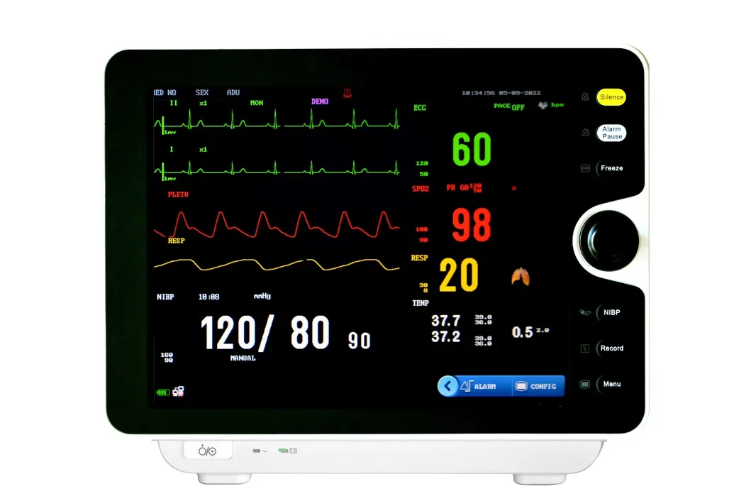 Monitor de Sinais Vitais
