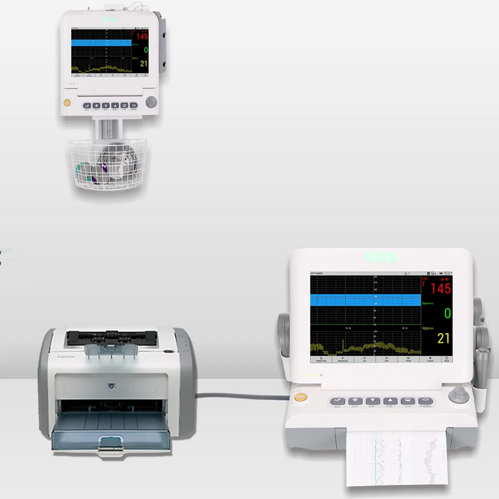 Monitor Fetal