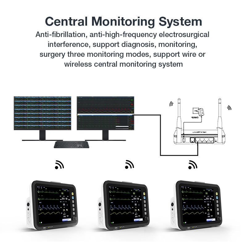 Monitor de Sinais Vitais Multiparamétrico Modular para Quarto de Paciente em UTI