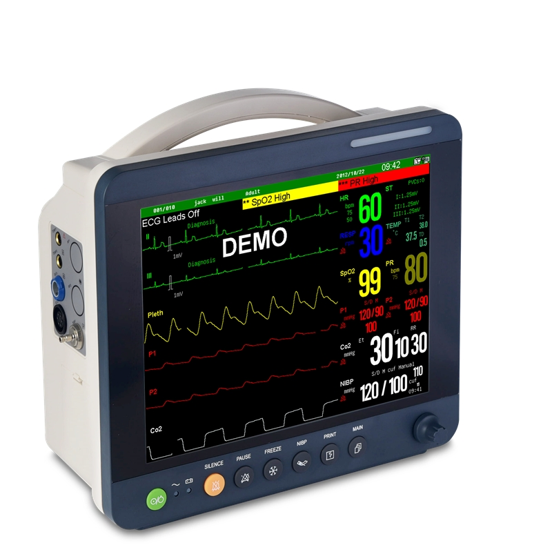 12inch Monitor de Paciente Multi Parâmetro com Tela Sensível ao Toque para Hospital Monitor de Paciente Portátil