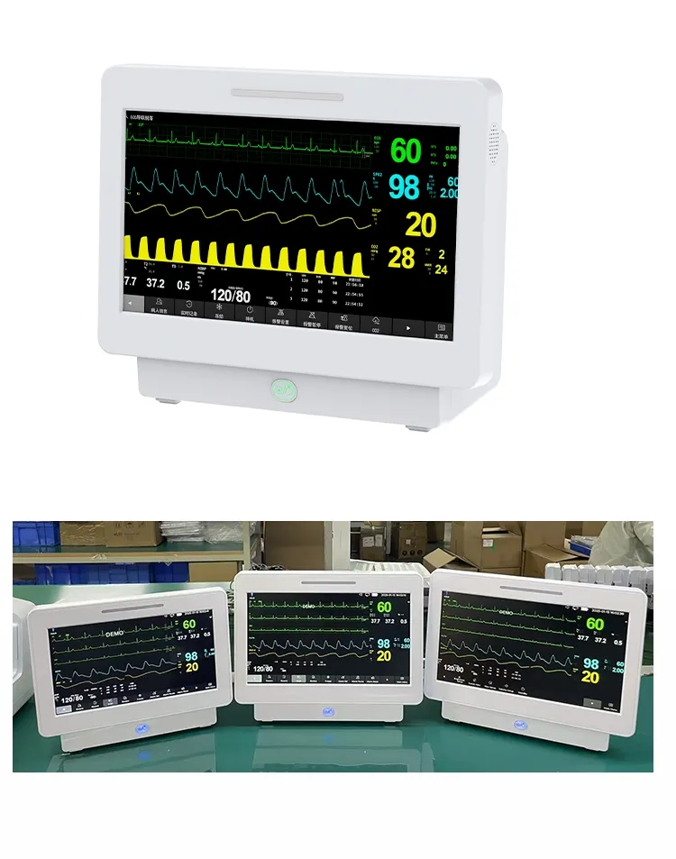 Monitor de Sinais Vitais 4