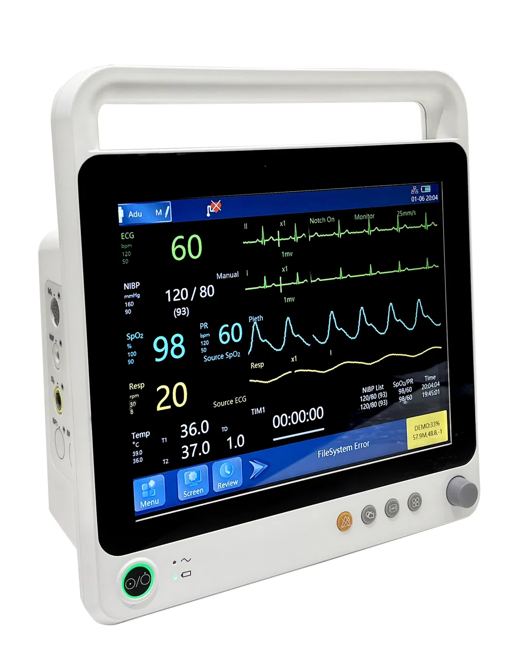 Monitor UTI