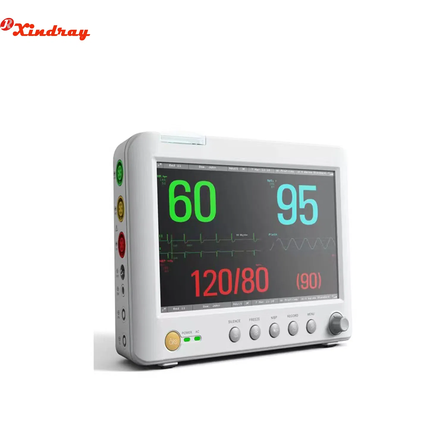 Equipamento Médico de Tela Sensível ao Toque para Quarto de UTI Monitor Portátil de Paciente com Múltiplos Parâmetros