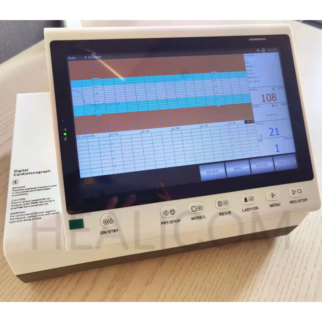Obstetrícia 10.2'' Monitor Fetal Portátil com Tela Touch LED para Pacientes de Ginecologia