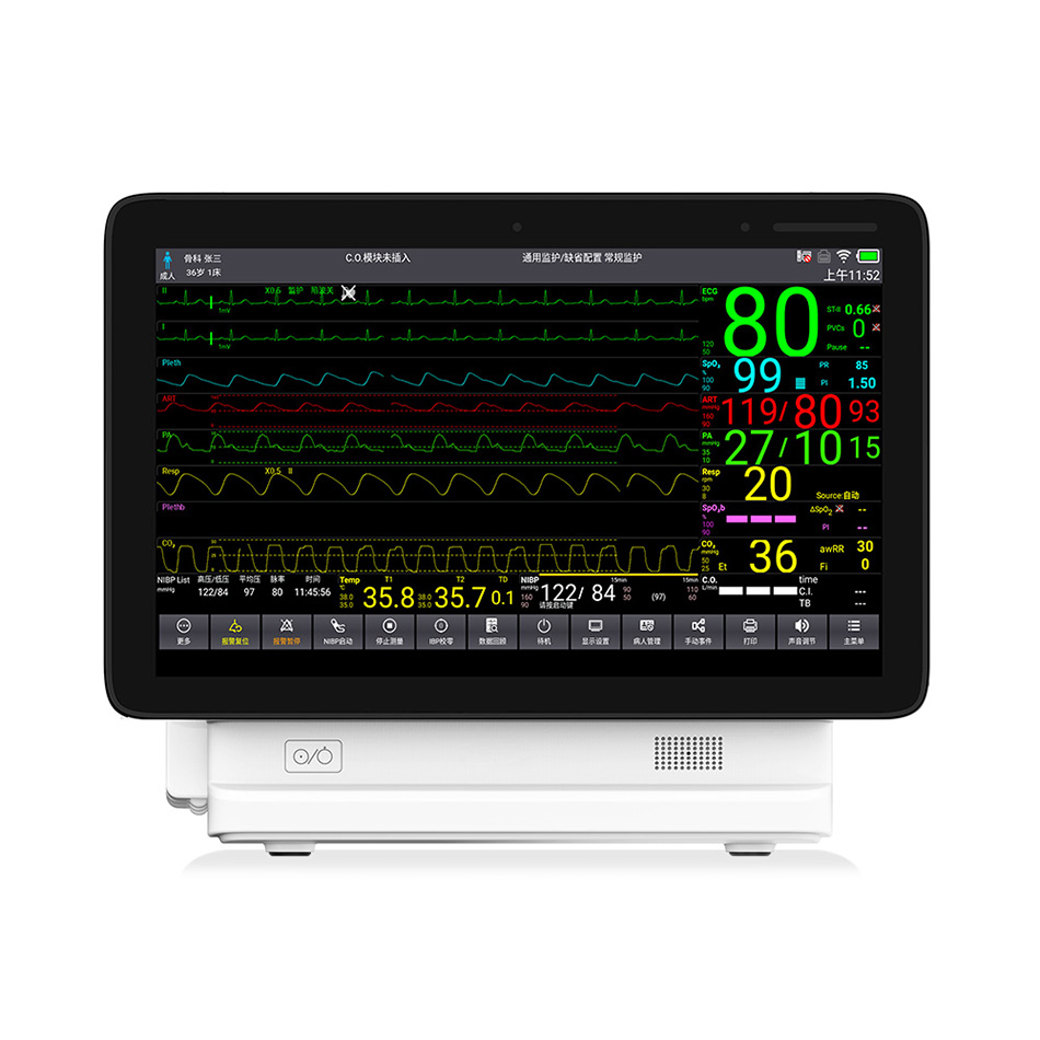 Dispositivos de Monitoramento Remoto de Pacientes Contec Ts15 Monitor Modular Portátil