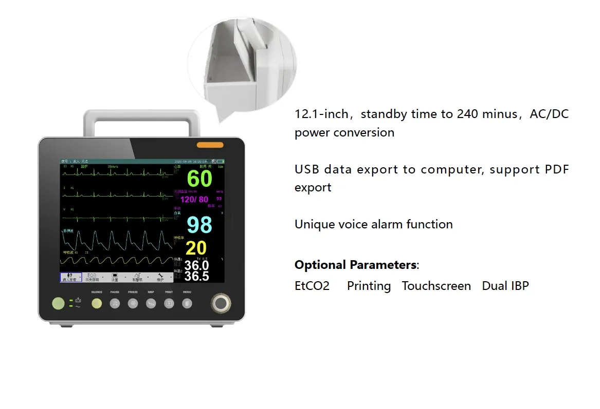 Advanced Monitor View