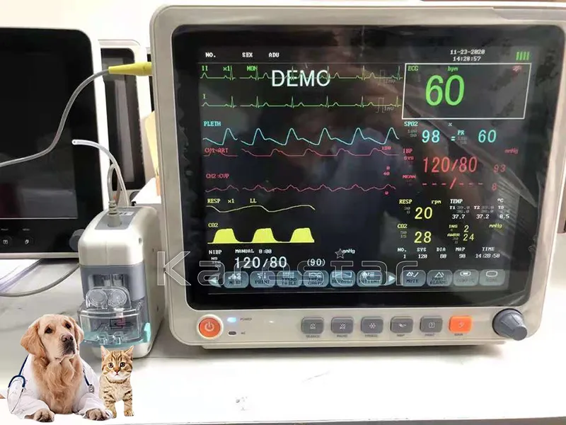 Monitor em Operação