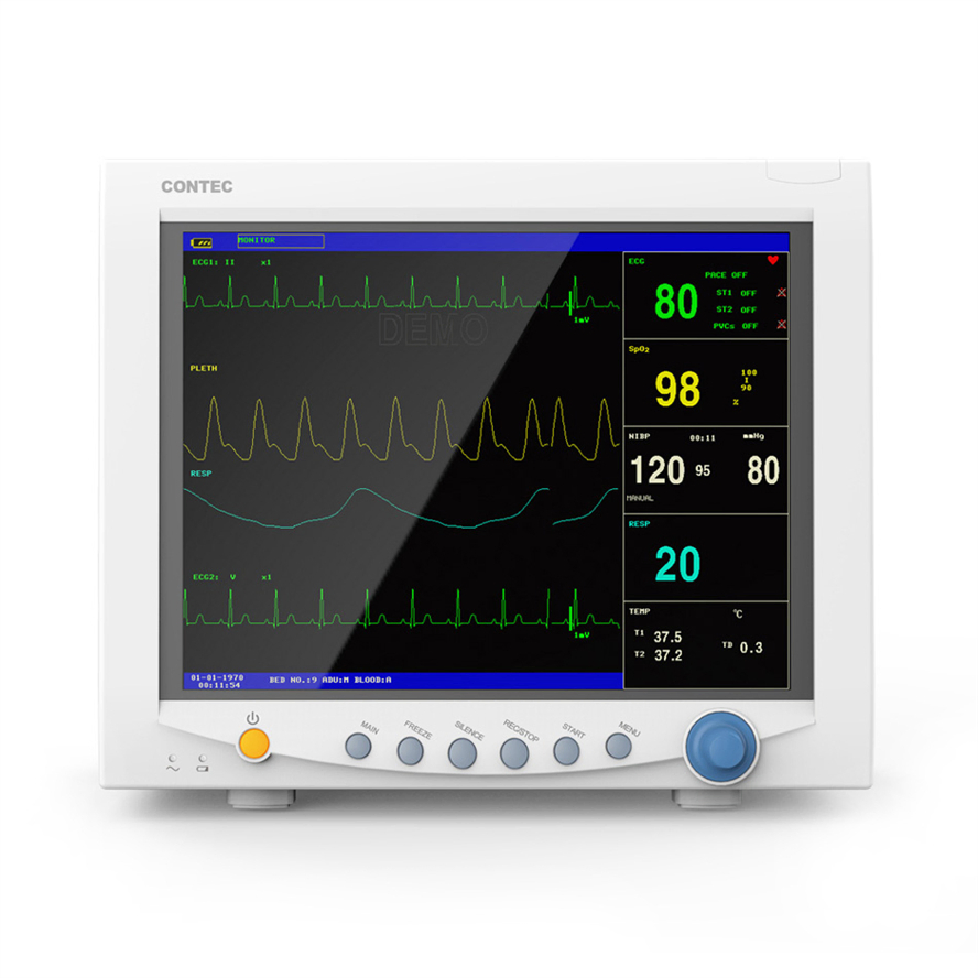 Instrumento de Diagnóstico ECG para Hospital Fetal Fornecimento Contec Mindray Simulador de Pressão Arterial Máquina Dental Dispositivo Médico Veterinário Monitor de Paciente