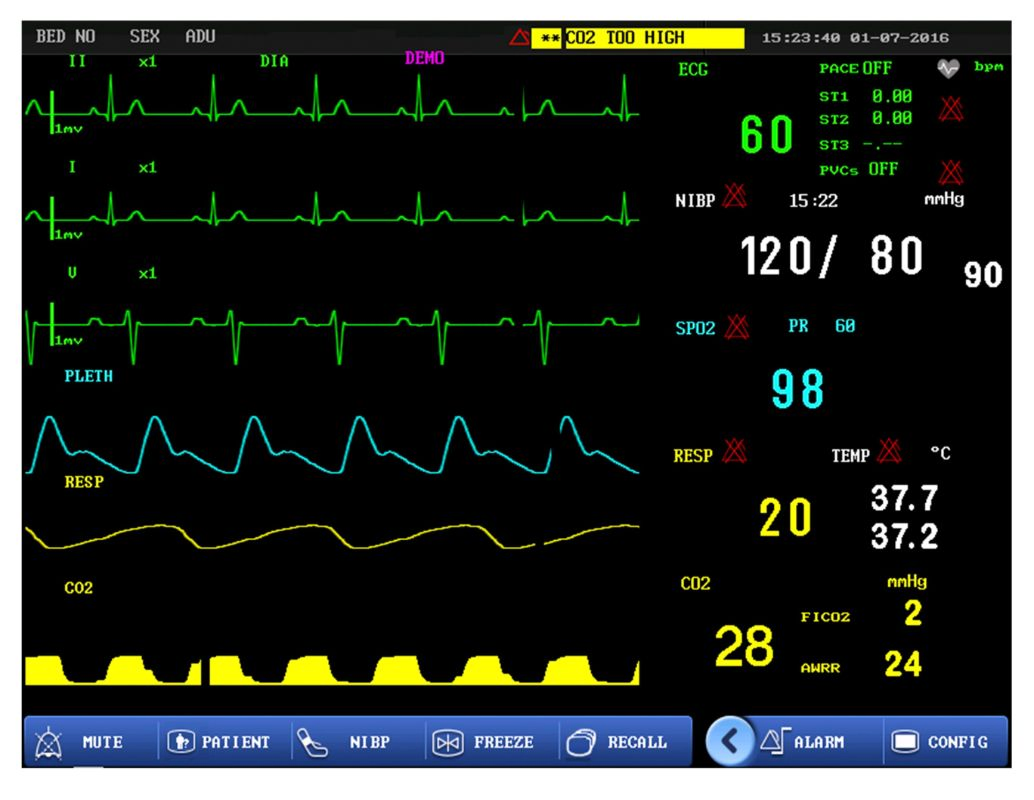 Monitor de Paciente de Equipamento Médico de Emergência do Hospital CE