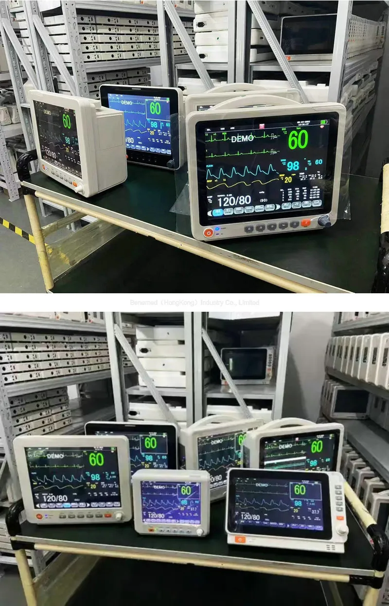 Monitor de UTI Detalhes