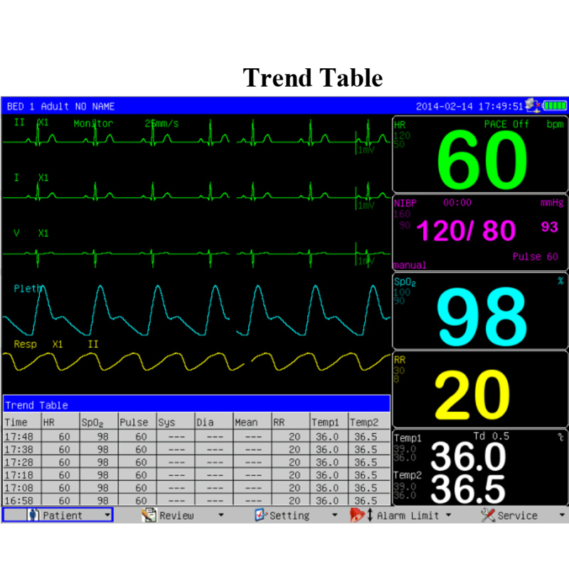 Monitor de Paciente Multicanal para Suprimentos Médicos com Tela Sensível ao Toque Opcional para UTI Hospitalar
