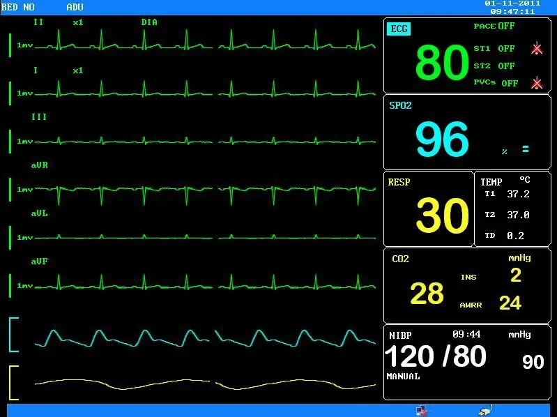 Monitor de Sinais Vitais Portátil Multi Parâmetro de Qualidade CE para Hospital (THR-PM3000)