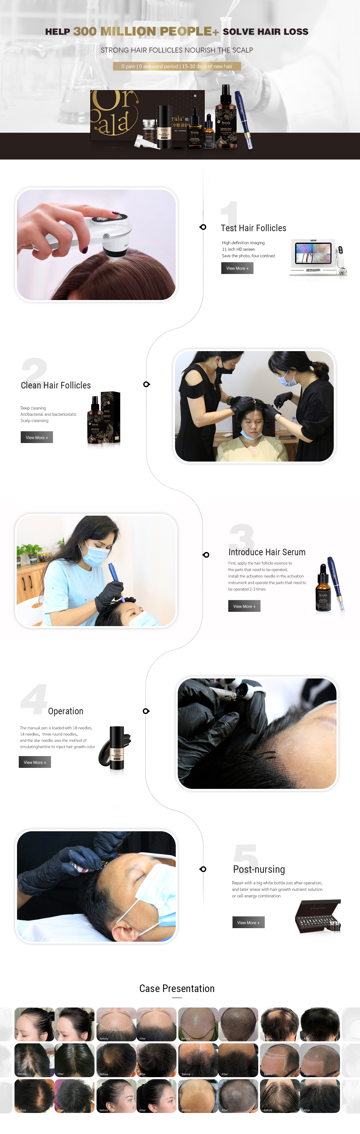 Anti Hair Loss Treatment for Hair Loss Prevention Scalp Ampoule Hair Serum with Stem Cell Essence
