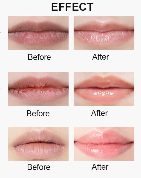 Popular Gray Packaging Lip Lightening Remove Wrinkles Peptide Lip Treatment Private Label