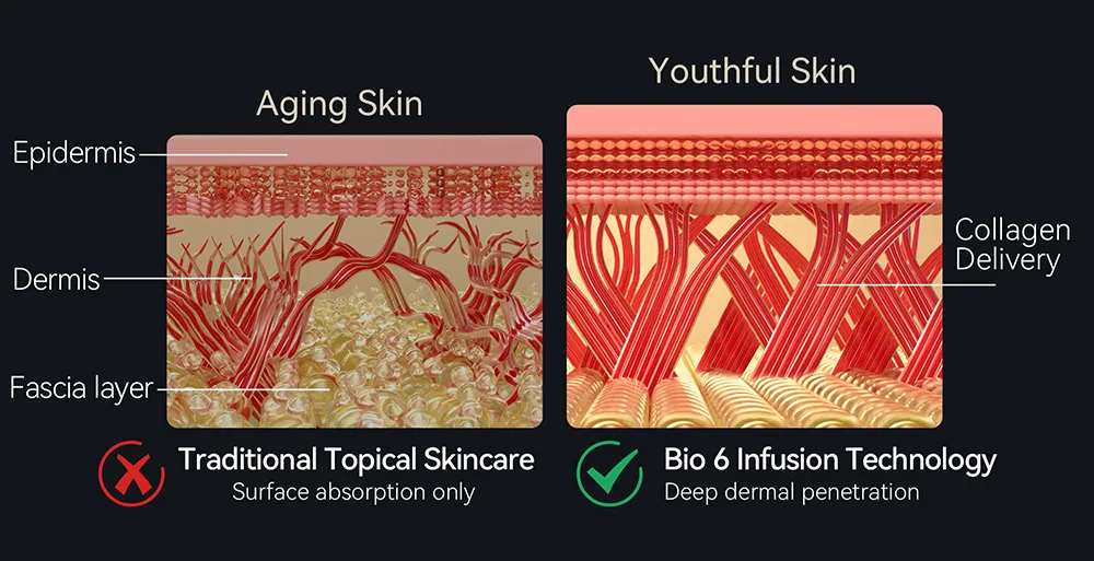 2026 New Electric Microneedle Facial Acne Removal, Anti-Aging, and Hair Growth