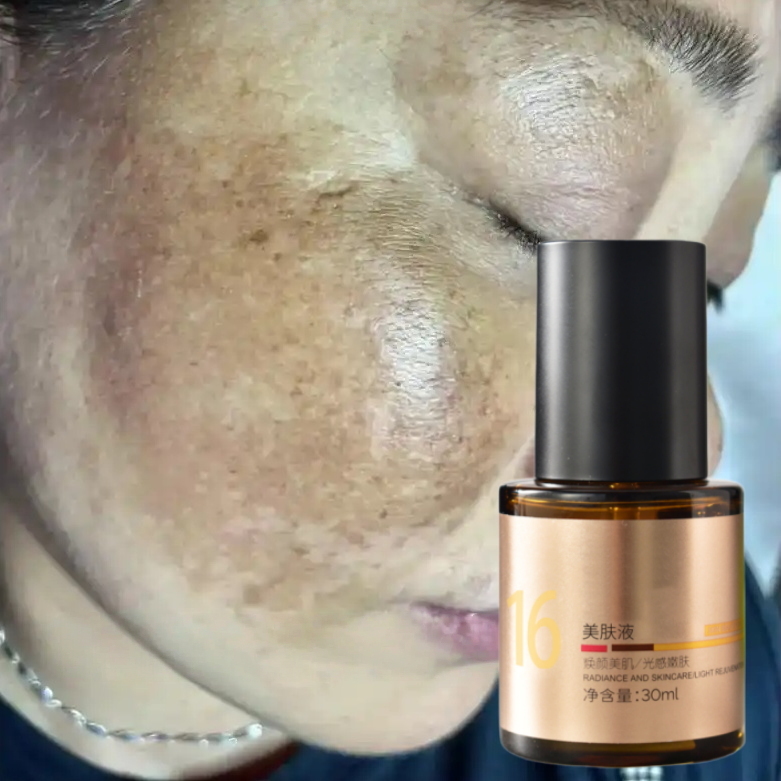 Whitening Blemish Face Skin Remove Heavy Metal-induced Spot Treatment Black Dark Spots Hyperpigmentation Remover Chelation Serum