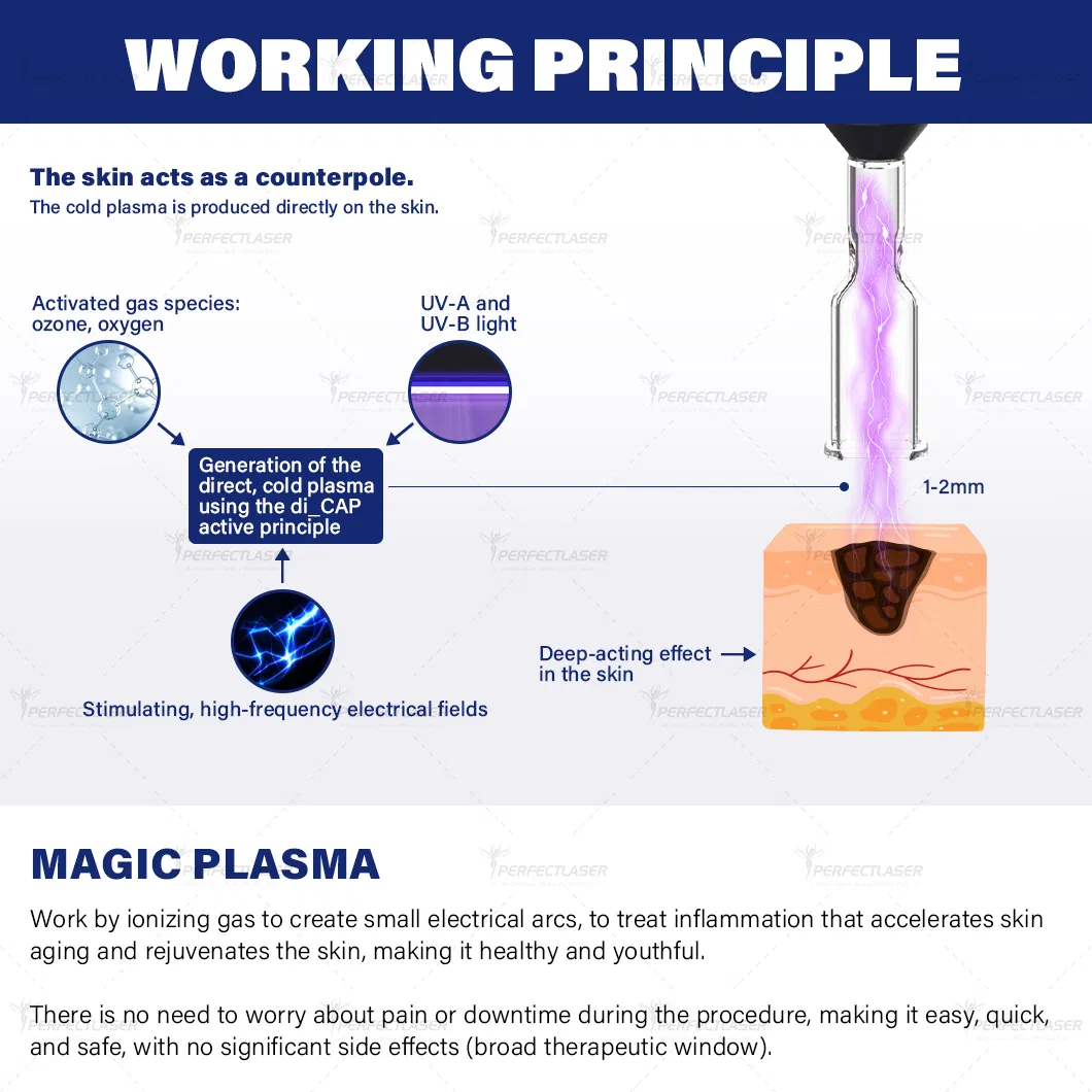 Working Principle