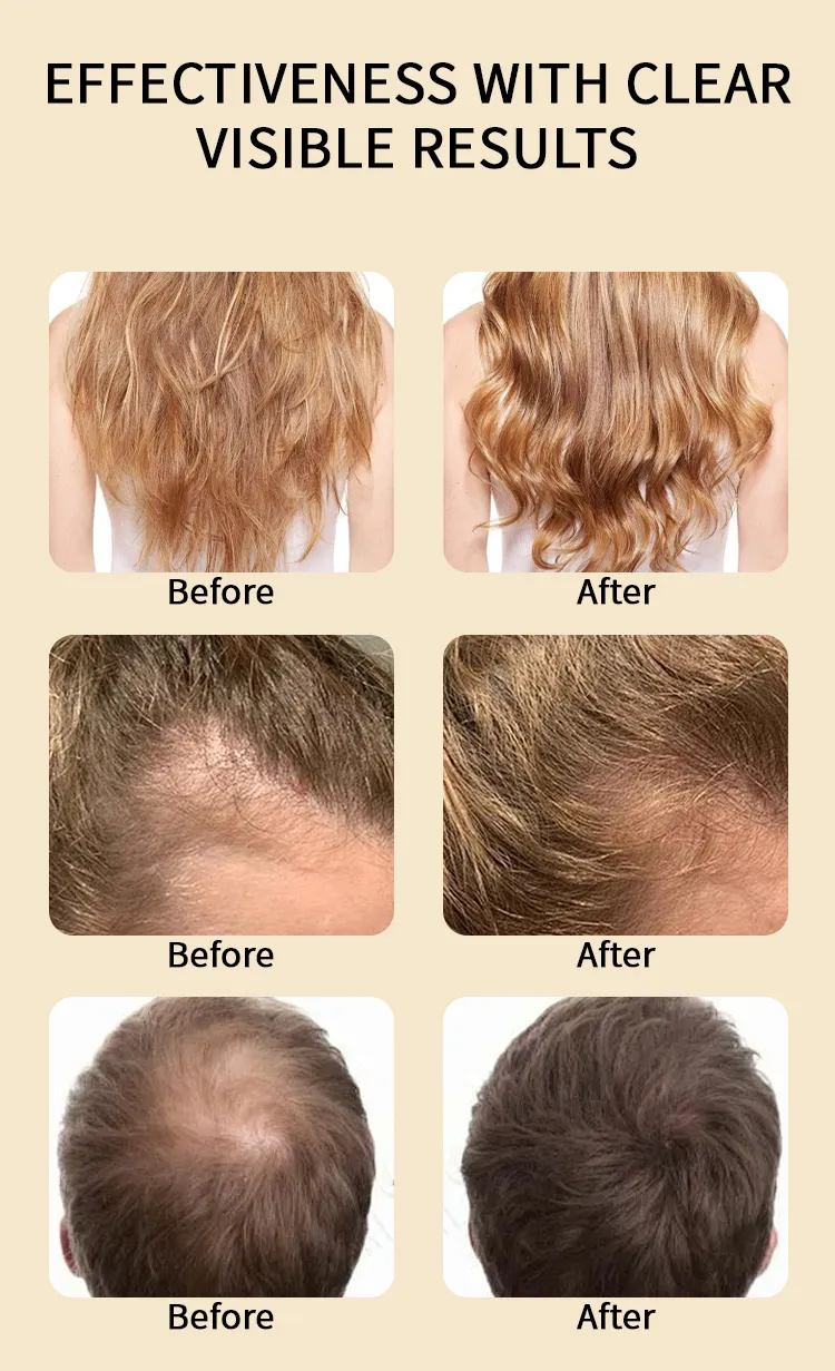 Custom Organic Batana Oil Hair Mask Shampoo Conditioner Promote Hair Growth Moisturizing Repair Damaged Batana Oil Hair Care Set