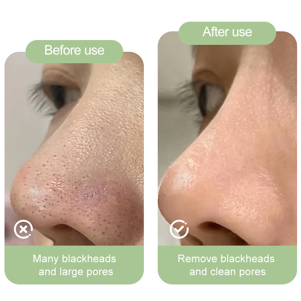 Private Label Natural Skin Remover Purifying Pore Nose Patch Custom Deep Cleaning Blackhead Charcoal Nose Strips
