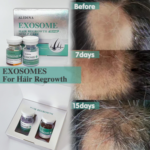 S Active Plant-Exo Anti-Hair Loss Solution EGF Stem Cell Peptides Serum Fast Hair Regrowth &amp; Scalp Rejuvenation Improve Alopecia