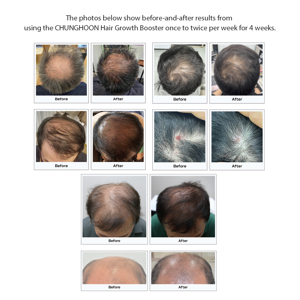 OEM PDRN Men Hair Booster Scalp Serum Anti Hair Loss Treatment Private Label Thinning Hair Growth Stimulating Solution Wholesale